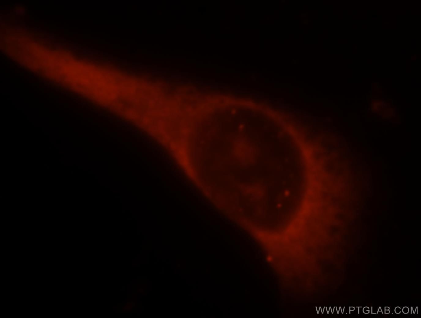 Immunofluorescence (IF) / fluorescent staining of A375 cells using LMOD1 Polyclonal antibody (15117-1-AP)