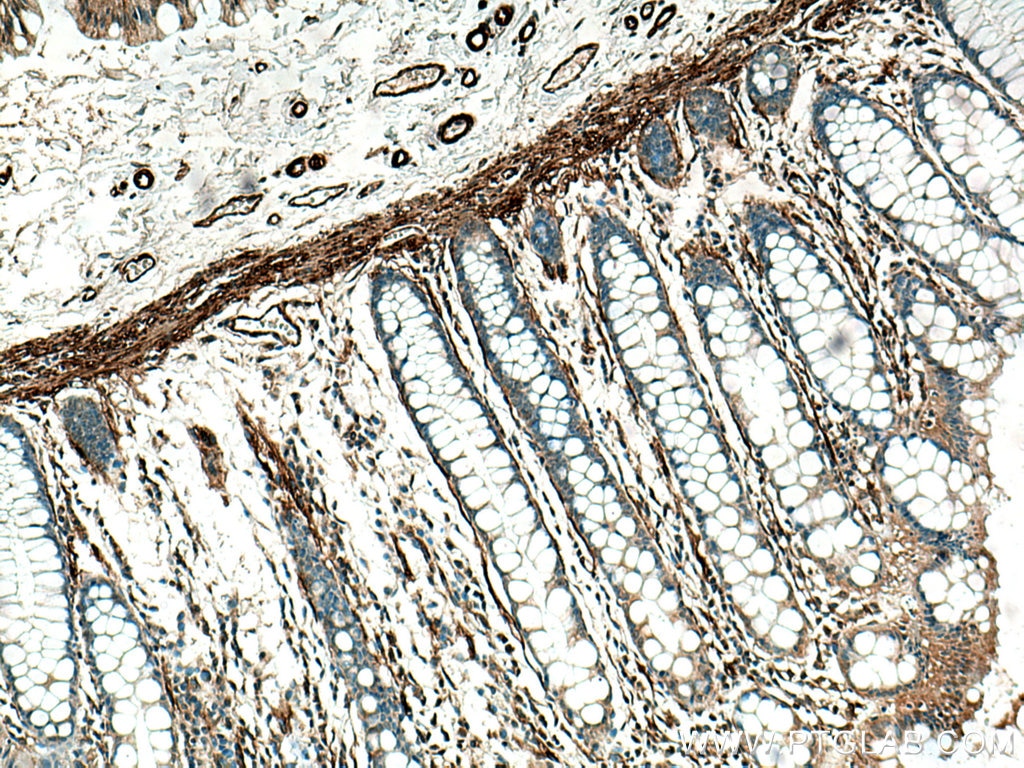 Immunohistochemistry (IHC) staining of human colon tissue using LMOD1 Polyclonal antibody (15117-1-AP)