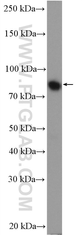 WB analysis of HT-29 using 15117-1-AP