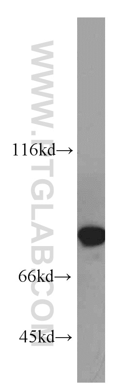 Western Blot (WB) analysis of mouse bladder tissue using LMOD1 Polyclonal antibody (15117-1-AP)