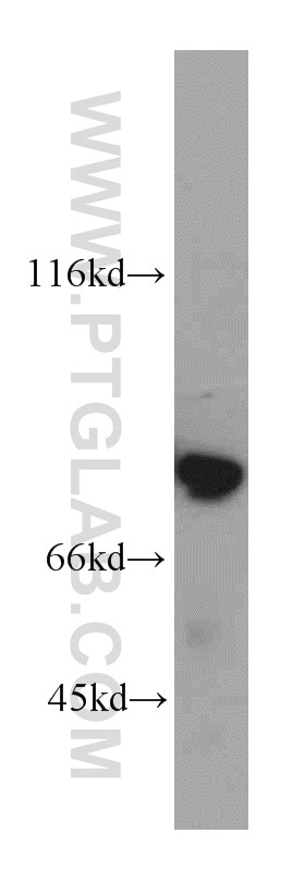 Western Blot (WB) analysis of mouse uterus tissue using LMOD1 Polyclonal antibody (15117-1-AP)