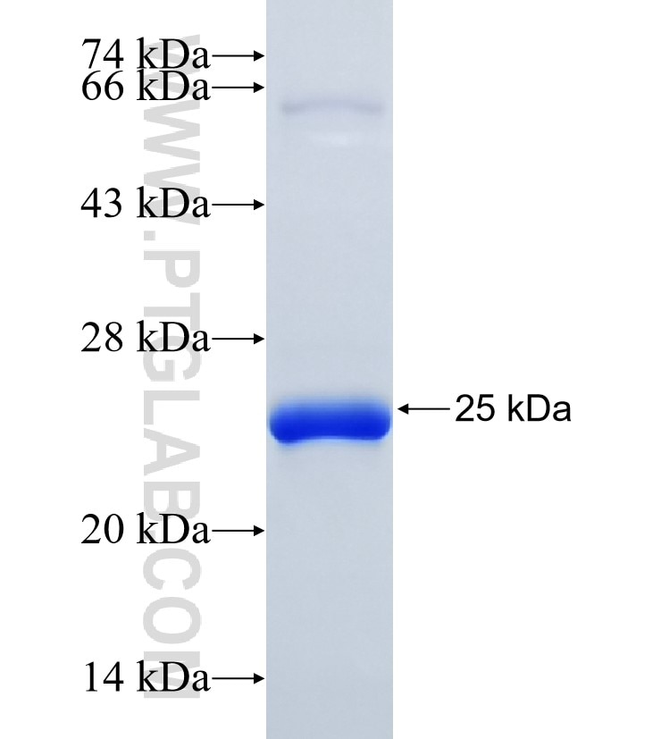 LMOD2 fusion protein Ag35362 SDS-PAGE LMOD2 fusion protein Ag35362 SDS-PAGE