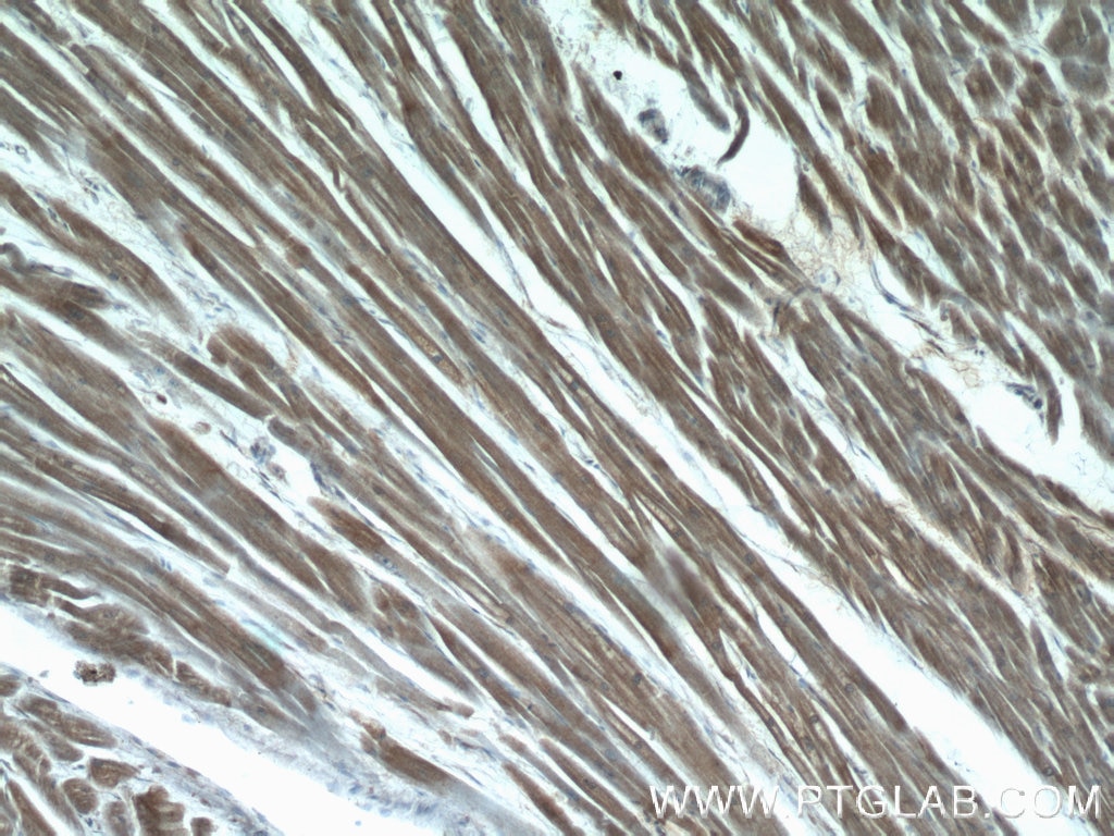 Immunohistochemistry (IHC) staining of human heart tissue using LMOD3 Polyclonal antibody (14948-1-AP)