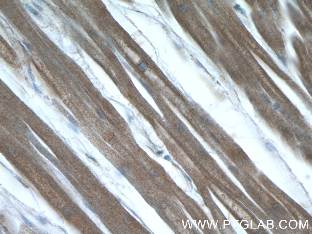 Immunohistochemistry (IHC) staining of human heart tissue using LMOD3 Polyclonal antibody (14948-1-AP)