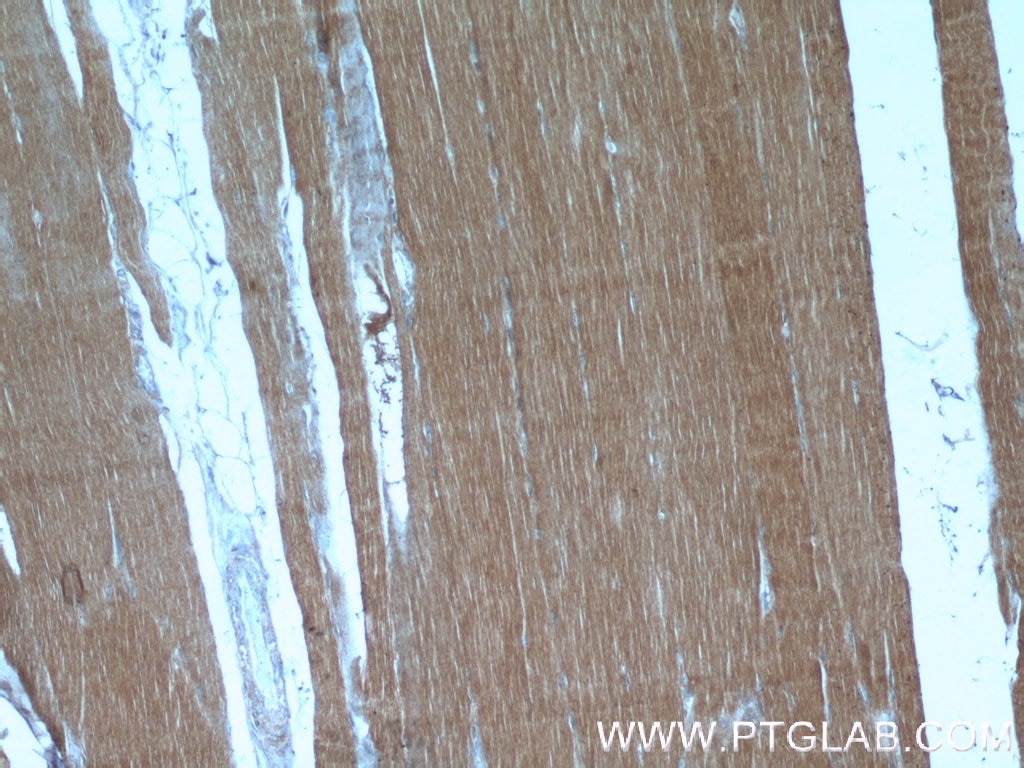 IHC staining of human skeletal muscle using 14948-1-AP