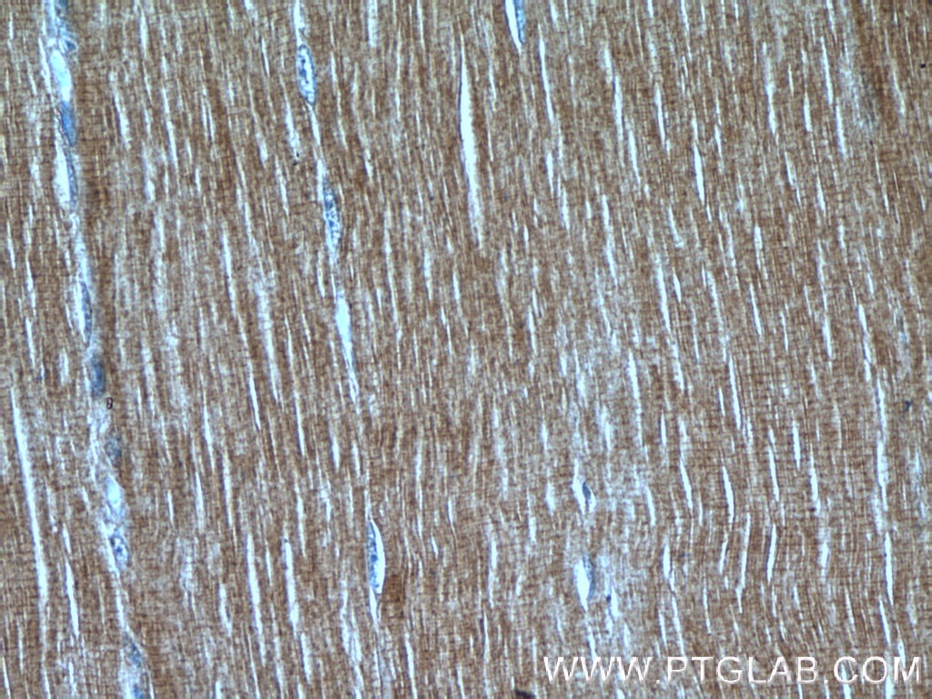 Immunohistochemistry (IHC) staining of human skeletal muscle tissue using LMOD3 Polyclonal antibody (14948-1-AP)