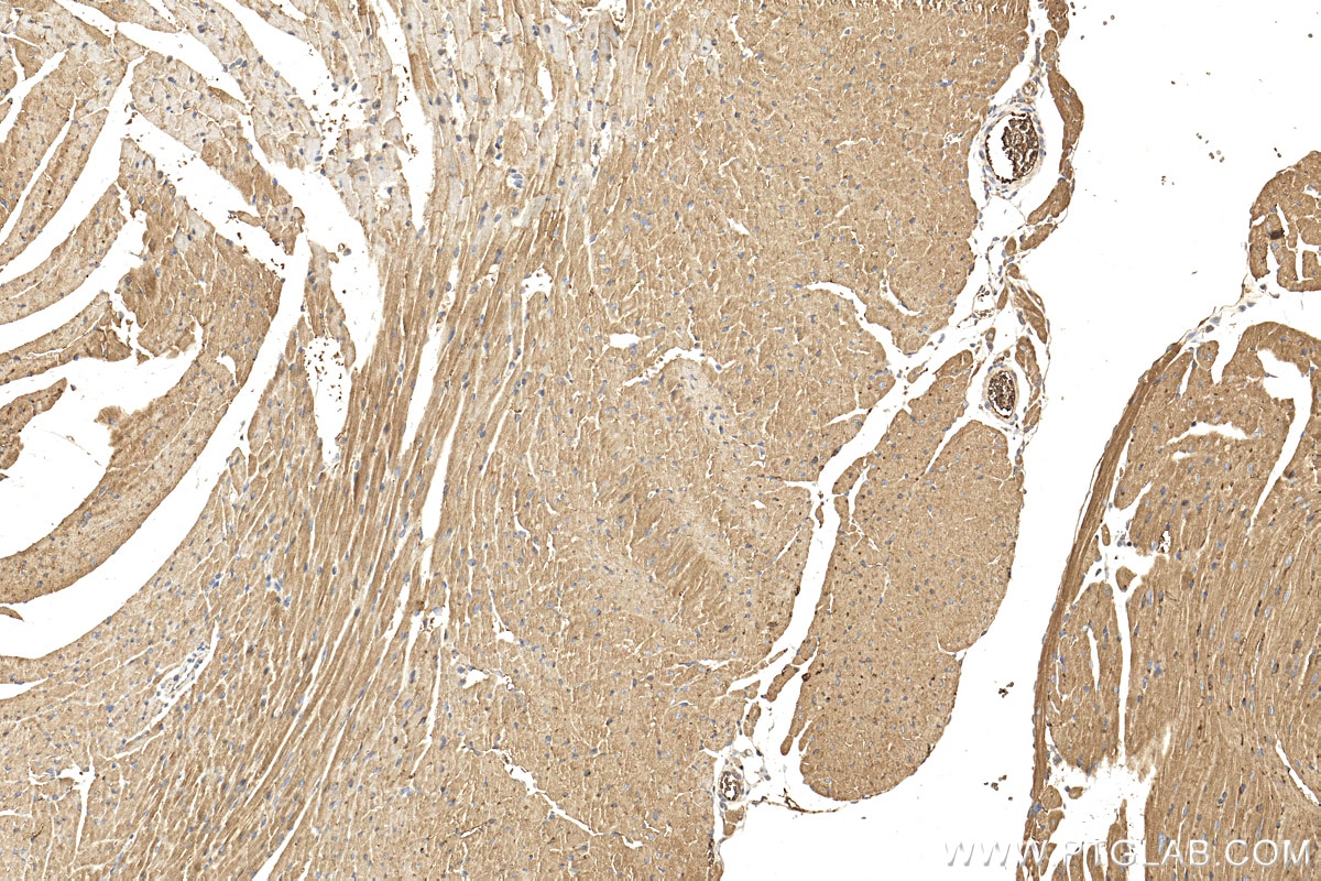 Immunohistochemistry (IHC) staining of mouse heart tissue using LMOD3 Polyclonal antibody (14948-1-AP)