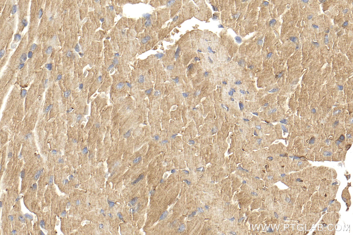 Immunohistochemistry (IHC) staining of mouse heart tissue using LMOD3 Polyclonal antibody (14948-1-AP)