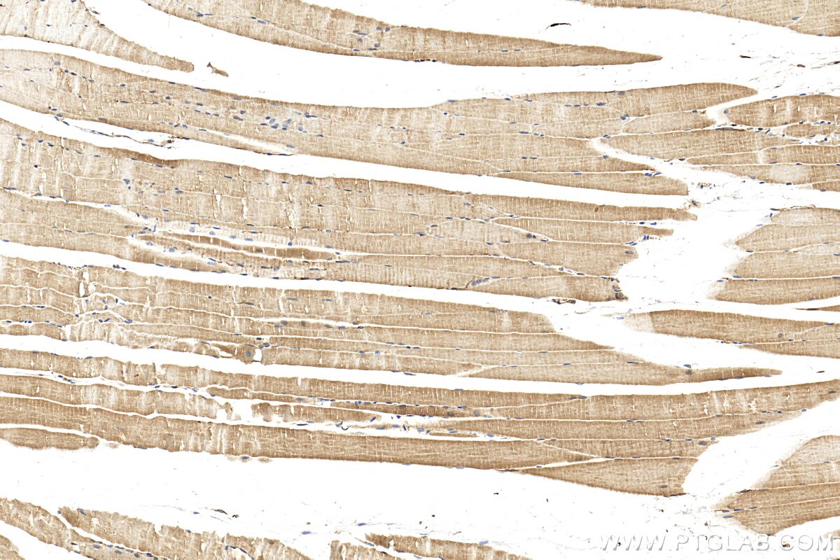 Immunohistochemistry (IHC) staining of mouse skeletal muscle tissue using LMOD3 Polyclonal antibody (14948-1-AP)