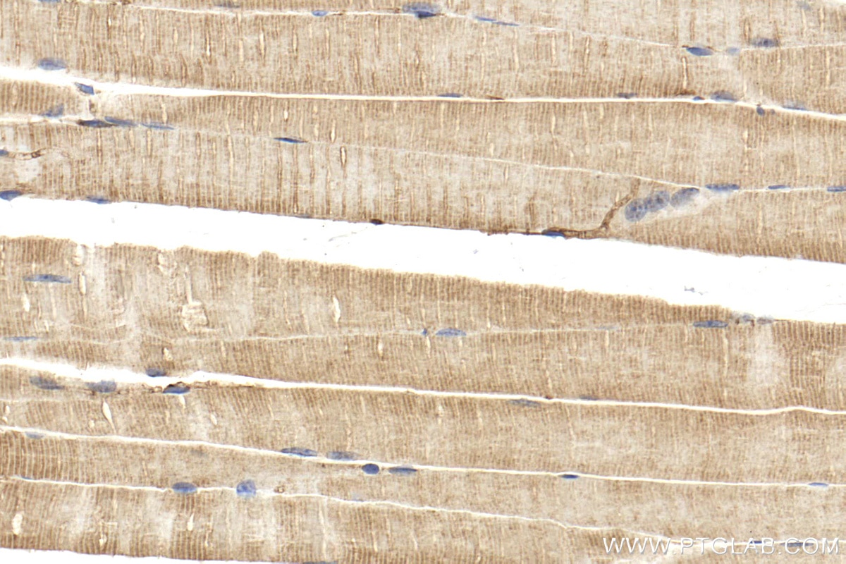 Immunohistochemistry (IHC) staining of mouse skeletal muscle tissue using LMOD3 Polyclonal antibody (14948-1-AP)