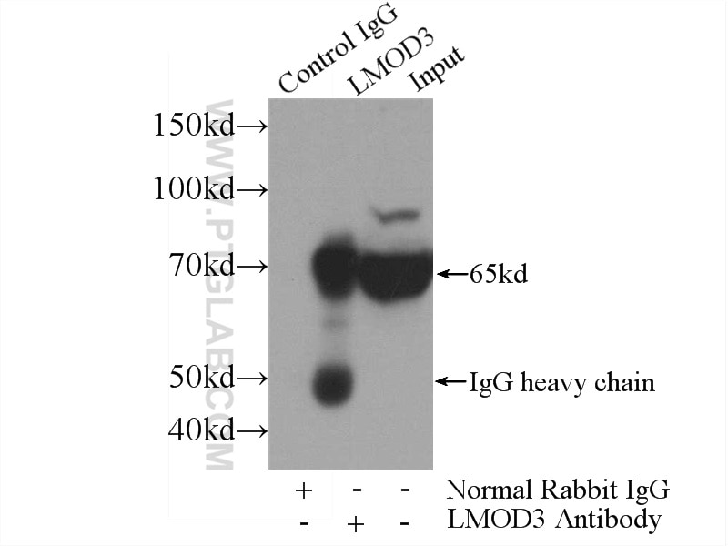 Immunoprecipitation (IP) experiment of mouse skeletal muscle tissue using LMOD3 Polyclonal antibody (14948-1-AP)