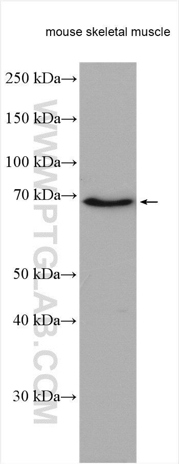 Western Blot (WB) analysis of various lysates using LMOD3 Polyclonal antibody (14948-1-AP)