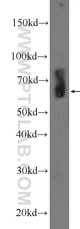 Western Blot (WB) analysis of rat skeletal muscle tissue using LMOD3 Polyclonal antibody (14948-1-AP)