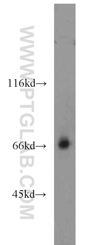 Western Blot (WB) analysis of mouse heart tissue using LMOD3 Polyclonal antibody (14948-1-AP)