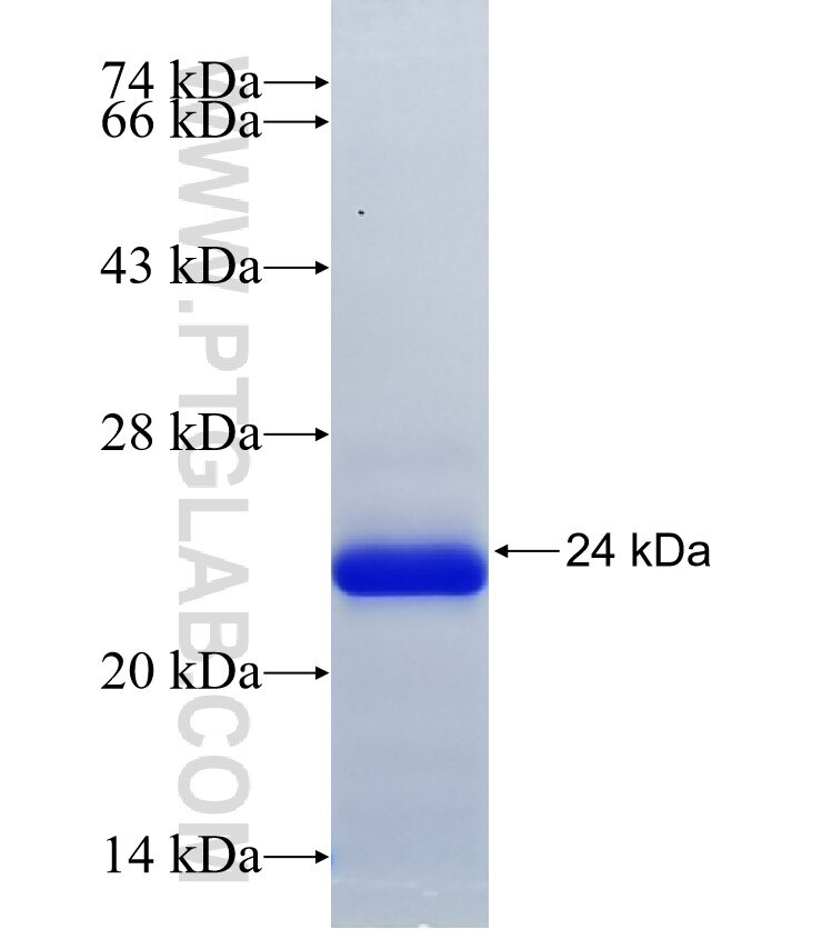 LMTK2 fusion protein Ag35493 SDS-PAGE