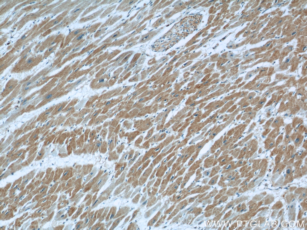 Immunohistochemistry (IHC) staining of human heart tissue using LNPEP Polyclonal antibody (55154-1-AP)