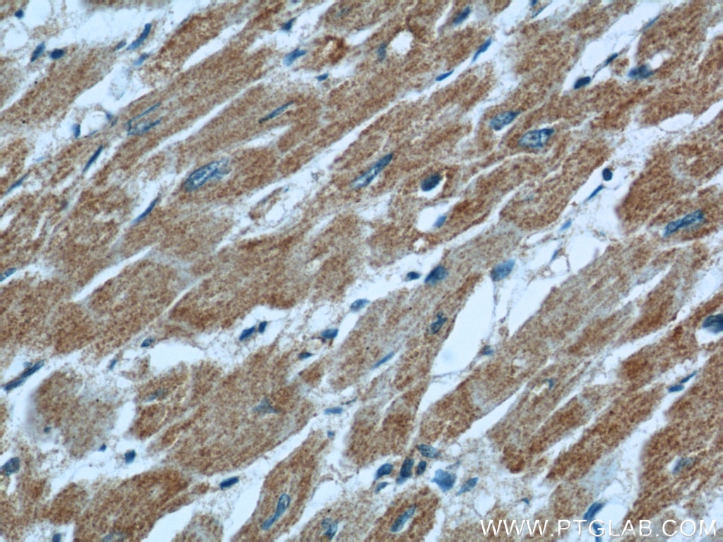 Immunohistochemistry (IHC) staining of human heart tissue using LNPEP Polyclonal antibody (55154-1-AP)