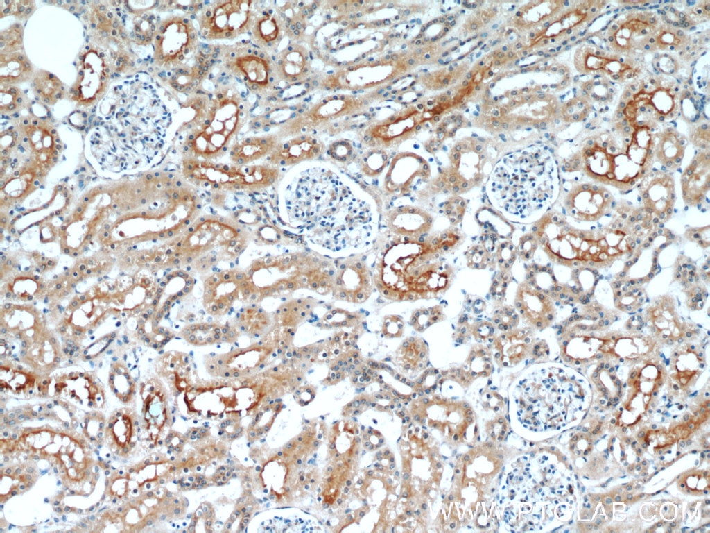 Immunohistochemistry (IHC) staining of human kidney tissue using LNPEP Polyclonal antibody (55154-1-AP)