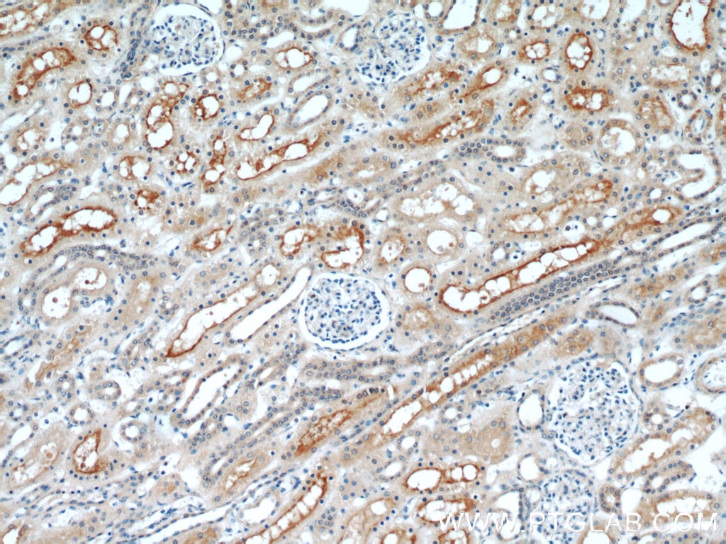 Immunohistochemistry (IHC) staining of human kidney tissue using LNPEP Polyclonal antibody (55154-1-AP)