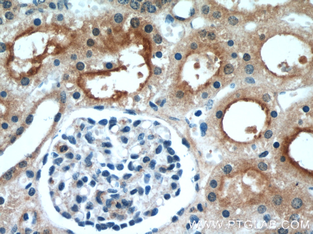 Immunohistochemistry (IHC) staining of human kidney tissue using LNPEP Polyclonal antibody (55154-1-AP)