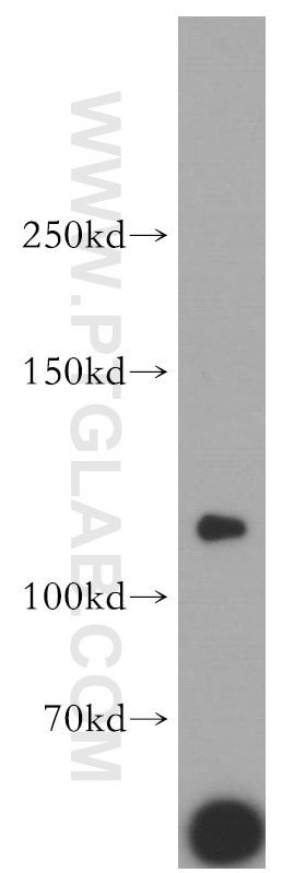 Western Blot (WB) analysis of human brain tissue using LNPEP Polyclonal antibody (55154-1-AP)