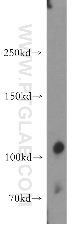 Western Blot (WB) analysis of human heart tissue using LNPEP Polyclonal antibody (55154-1-AP)