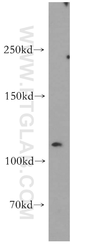 Western Blot (WB) analysis of COLO 320 cells using LNPEP Polyclonal antibody (55154-1-AP)