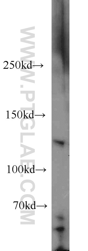 Western Blot (WB) analysis of human brain tissue using LNPEP Polyclonal antibody (55154-1-AP)