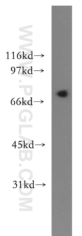 Western Blot (WB) analysis of mouse testis tissue using LNX1 Polyclonal antibody (13124-1-AP)