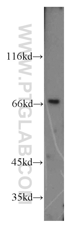 Western Blot (WB) analysis of mouse kidney tissue using LNX1 Polyclonal antibody (13124-1-AP)