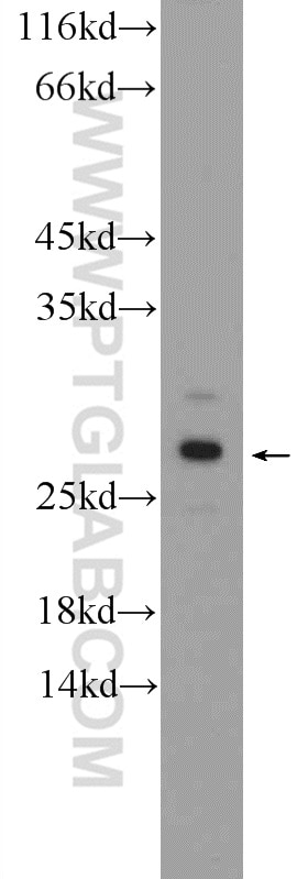 Western Blot (WB) analysis of mouse liver tissue using AGPHD1 Polyclonal antibody (26070-1-AP)