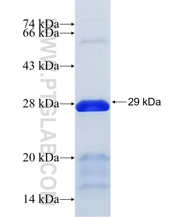 LOC284805 fusion protein Ag34401 SDS-PAGE LOC284805 fusion protein Ag34401 SDS-PAGE