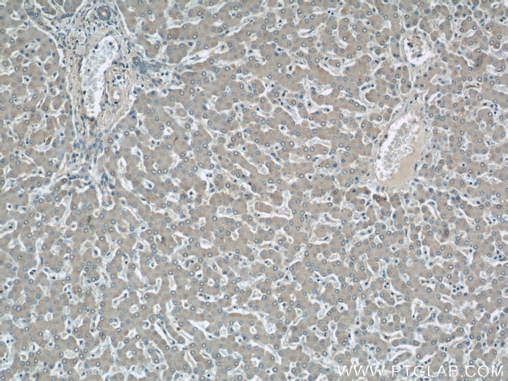 Immunohistochemistry (IHC) staining of human liver tissue using LOC286135 Polyclonal antibody (21958-1-AP)