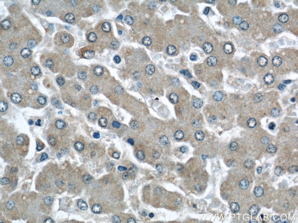 Immunohistochemistry (IHC) staining of human liver tissue using LOC286135 Polyclonal antibody (21958-1-AP)