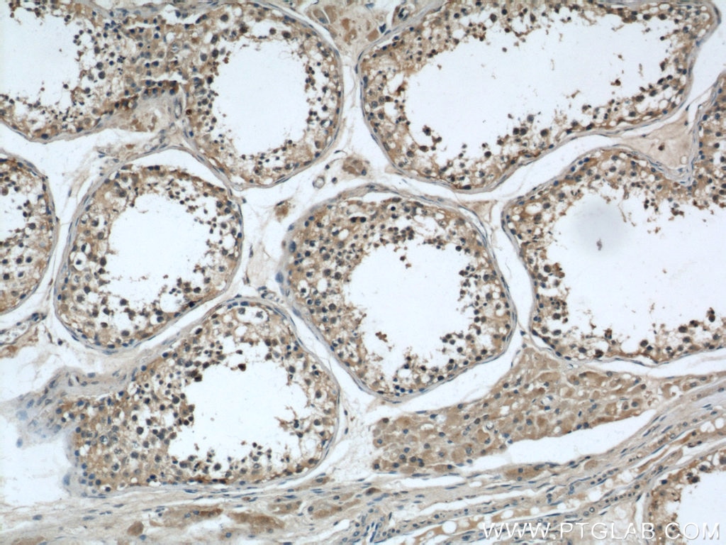 Immunohistochemistry (IHC) staining of human testis tissue using LOC286135 Polyclonal antibody (21958-1-AP)