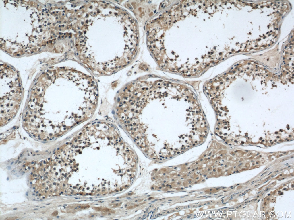 IHC staining of human testis using 21958-1-AP