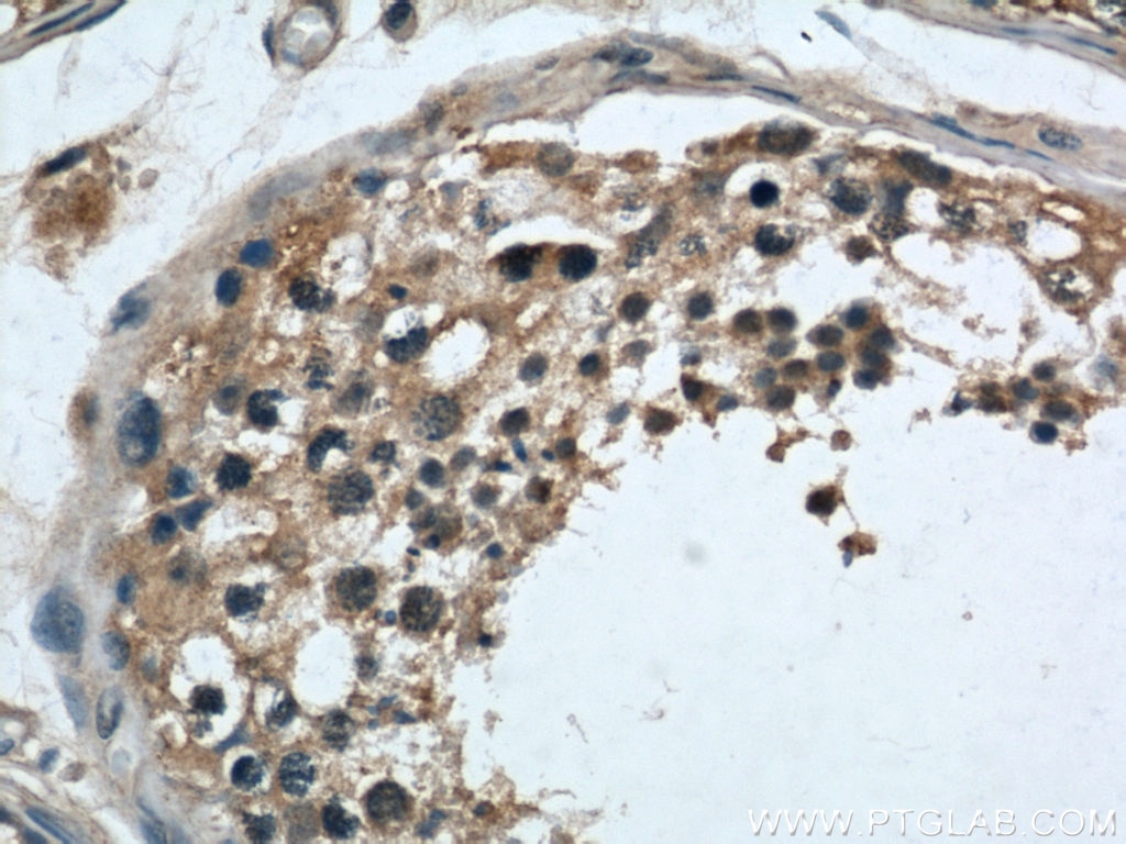 Immunohistochemistry (IHC) staining of human testis tissue using LOC286135 Polyclonal antibody (21958-1-AP)