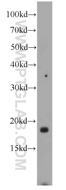 Western Blot (WB) analysis of mouse brain tissue using LOC286135 Polyclonal antibody (21958-1-AP)