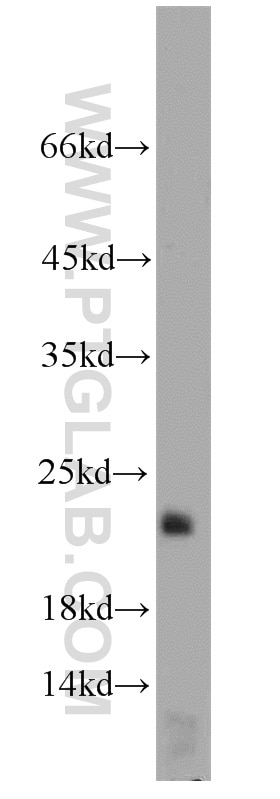 Western Blot (WB) analysis of mouse brain tissue using LOC286135 Polyclonal antibody (21958-1-AP)