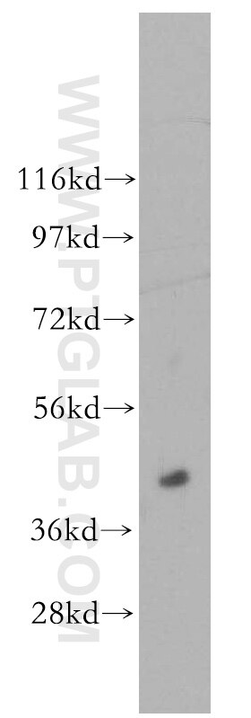 Western Blot (WB) analysis of human brain tissue using ACOT7L Polyclonal antibody (51016-2-AP)