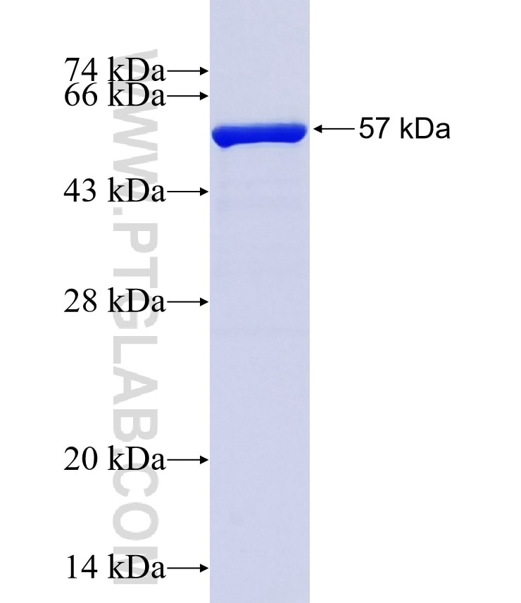 LOC375337 fusion protein Ag37936 SDS-PAGE LOC375337 fusion protein Ag37936 SDS-PAGE