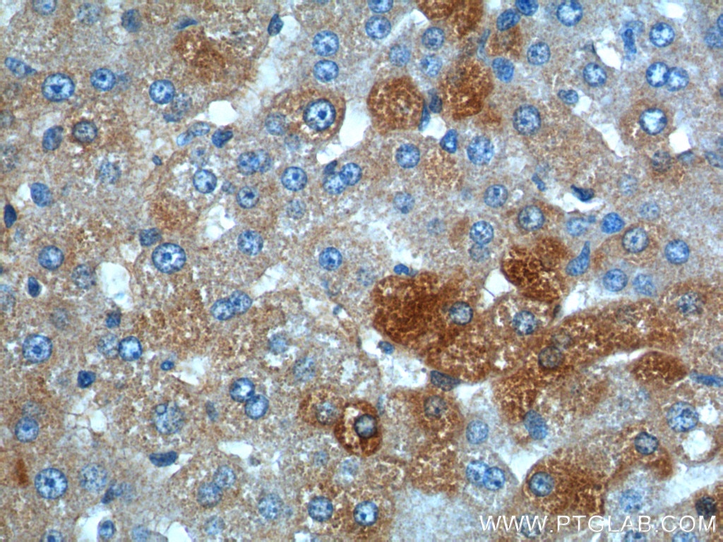 Immunohistochemistry (IHC) staining of human liver tissue using ANGPTL8/Betatrophin Polyclonal antibody (23792-1-AP)