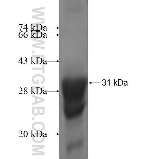 LOC57228 fusion protein Ag6988 SDS-PAGE
