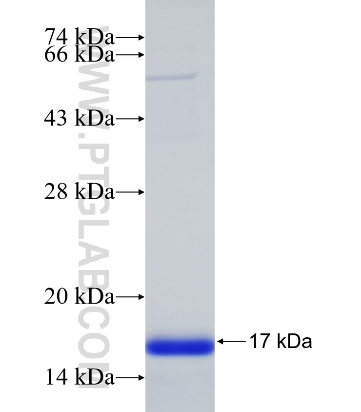 LOC645676 fusion protein Ag32593 SDS-PAGE LOC645676 fusion protein Ag32593 SDS-PAGE