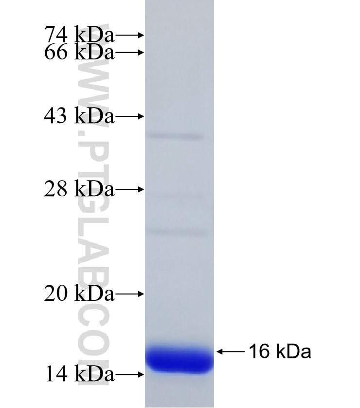 LOC652968 fusion protein Ag30817 SDS-PAGE LOC652968 fusion protein Ag30817 SDS-PAGE