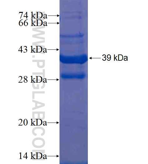 MEF2BNB fusion protein Ag1370 SDS-PAGE