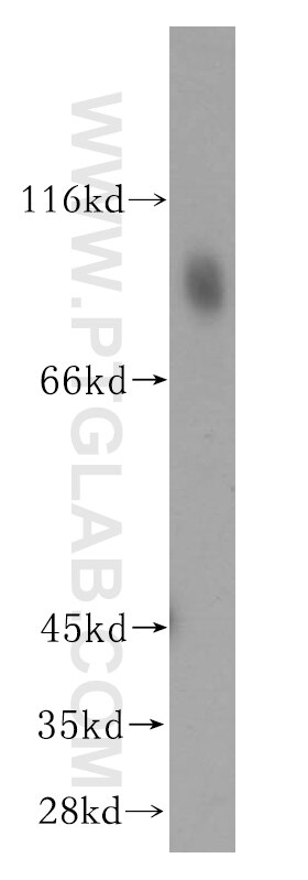 Western Blot (WB) analysis of human kidney tissue using LOC81691 Polyclonal antibody (15762-1-AP)