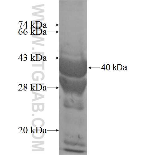 LOC81691 fusion protein Ag8370 SDS-PAGE