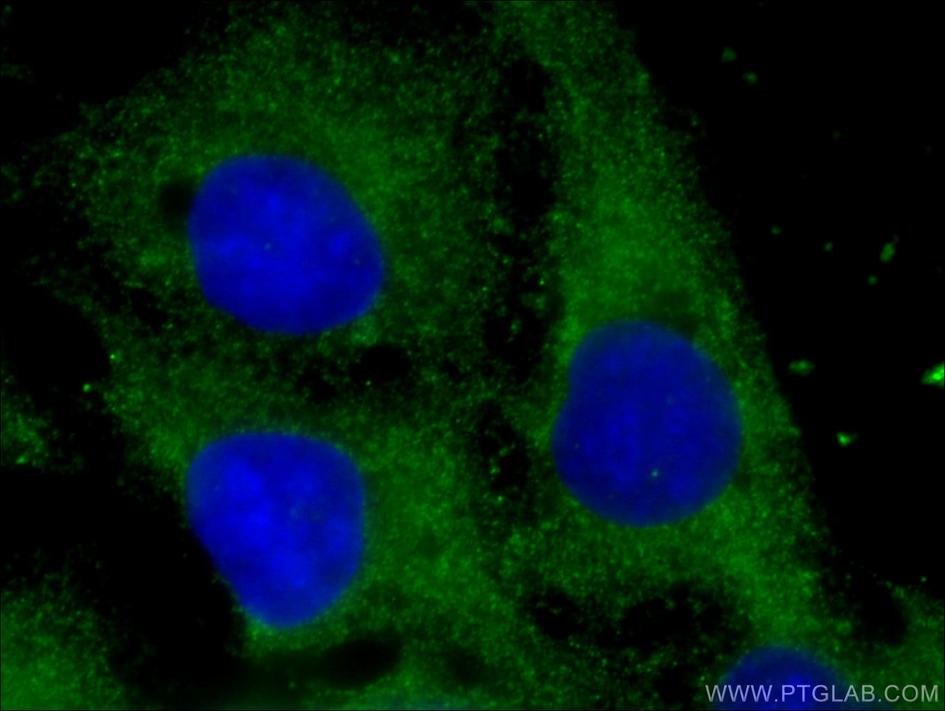 Immunofluorescence (IF) / fluorescent staining of U2OS cells using LOH12CR1 Polyclonal antibody (17169-1-AP)