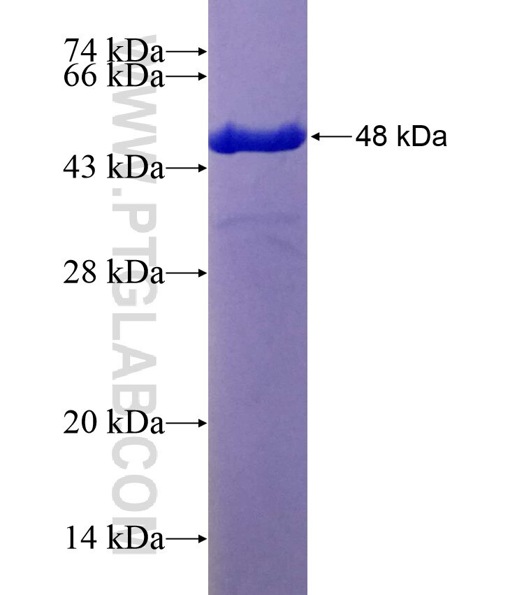 LOH12CR1 fusion protein Ag10695 SDS-PAGE